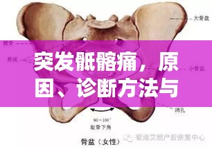 突發(fā)骶髂痛，原因、診斷方法與治療策略